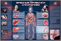 Электрифицированный стенд "Вредные привычки: алкоголизм" - fgospostavki.ru - Александров