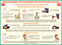 Таблица "Порядок действий при опасном кровотечении" (100х140 сантиметров, винил) - fgospostavki.ru - Александров