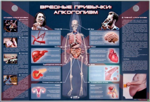 Электрифицированный стенд "Вредные привычки: алкоголизм" - fgospostavki.ru - Александров